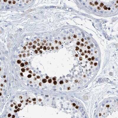 Immunohistochemistry-Paraffin: SGOL2 Antibody [NBP1-83567]