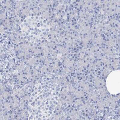 Immunohistochemistry-Paraffin: SGOL2 Antibody [NBP1-83567]