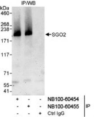 Immunoprecipitation: SGOL2 Antibody [NB100-60454]