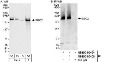 Western Blot: SGOL2 Antibody [NB100-60455]