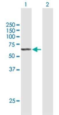 Western Blot: SGPL1 Antibody [H00008879-B01P]