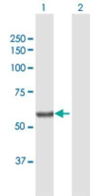 Western Blot: SGPL1 Antibody [H00008879-D01P]