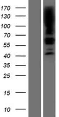 Western Blot: SGPL1 Overexpression Lysate [NBP2-07936]