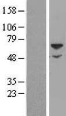 Western Blot: Sulfamidase/SGSH Overexpression Lysate [NBL1-15913]