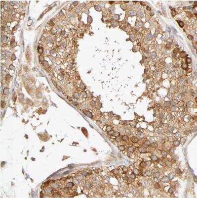 Immunohistochemistry-Paraffin: SGSM1 Antibody [NBP1-93564]