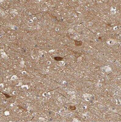 Immunohistochemistry-Paraffin: SGSM1 Antibody [NBP1-93564]