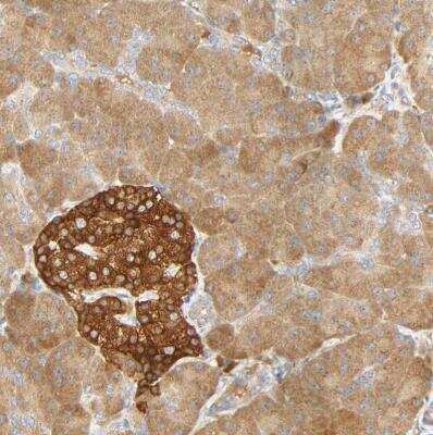 Immunohistochemistry-Paraffin: SGSM1 Antibody [NBP1-93564]