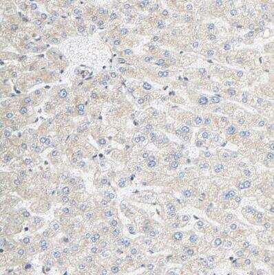 Immunohistochemistry-Paraffin: SGSM1 Antibody [NBP1-93564]