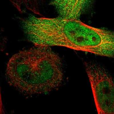 Immunocytochemistry/ Immunofluorescence: SGSM2 Antibody [NBP1-93637]