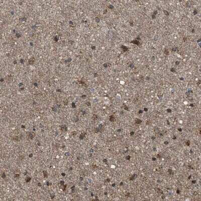 Immunohistochemistry-Paraffin: SGSM2 Antibody [NBP1-93637]