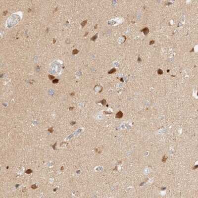 Immunohistochemistry-Paraffin: SGSM2 Antibody [NBP1-93638]