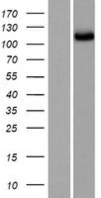 Western Blot: SGSM2 Overexpression Lysate [NBP2-08312]