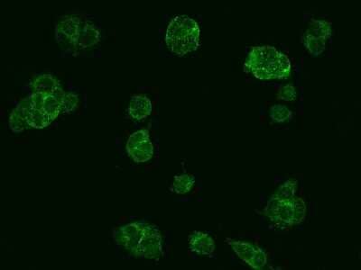 Immunocytochemistry/ Immunofluorescence: SGSM3 Antibody [NBP2-97659]