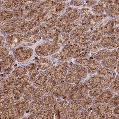 Immunohistochemistry-Paraffin: SGSM3 Antibody [NBP2-13304]