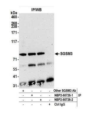 Immunoprecipitation: SGSM3 Antibody [NBP2-60726]