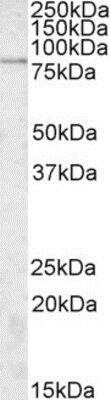 Western Blot: SGSM3 Antibody [NBP1-45207]