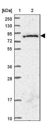 Western Blot: SGSM3 Antibody [NBP2-13304]