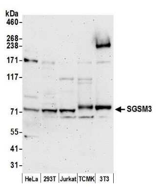 Western Blot: SGSM3 Antibody [NBP2-60726]