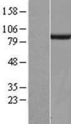 Western Blot: SGSM3 Overexpression Lysate [NBL1-15914]