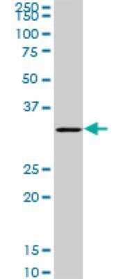 Western Blot: SGTA Antibody (2E11) [H00006449-M06]