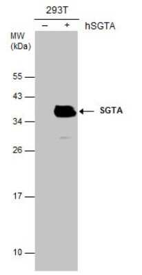 Western Blot: SGTA Antibody (6A4) [NBP3-13529]