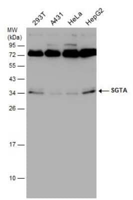 Western Blot: SGTA Antibody (6A4) [NBP3-13529]