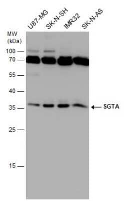 Western Blot: SGTA Antibody (6A4) [NBP3-13529]