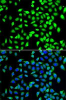 Immunocytochemistry/ Immunofluorescence: SGTA Antibody - BSA Free [NBP3-03246]