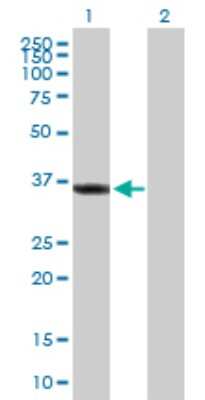 Western Blot: SGTA Antibody [H00006449-B01P]