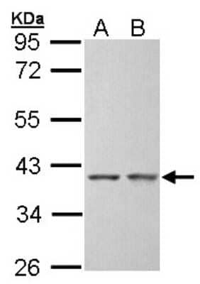 Western Blot: SGTA Antibody [NBP1-31304]