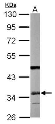 Western Blot: SGTA Antibody [NBP2-20339]