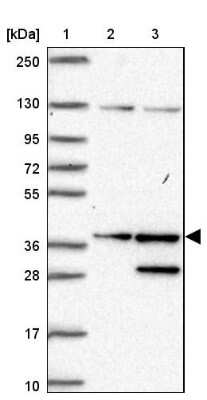 Western Blot: SGTA Antibody [NBP2-47279]