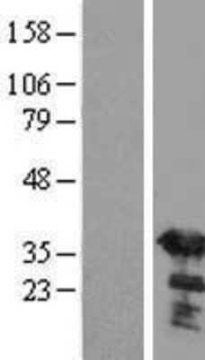 Western Blot: SGTA Overexpression Lysate [NBL1-15915]