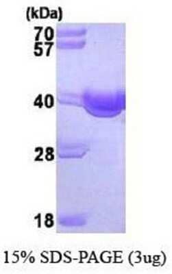 SDS-PAGE: Recombinant Human SGTA His Protein [NBP1-44491]