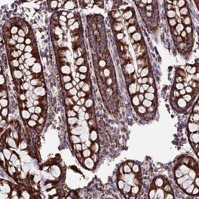 Immunohistochemistry-Paraffin: SGTB Antibody [NBP1-92385]