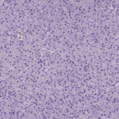 Immunohistochemistry-Paraffin: SGTB Antibody [NBP2-38998]