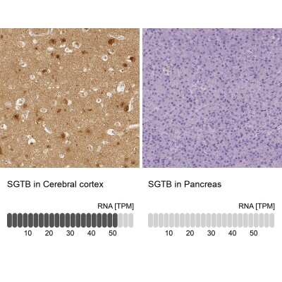Immunohistochemistry-Paraffin: SGTB Antibody [NBP2-38998]