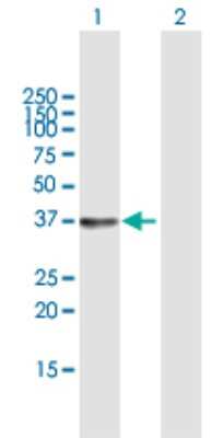 Western Blot: SGTB Antibody [H00054557-B01P]