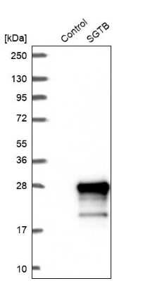 Western Blot: SGTB Antibody [NBP2-38998]