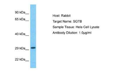 Western Blot: SGTB Antibody [NBP2-88258]