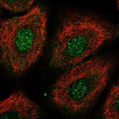 Immunocytochemistry/ Immunofluorescence: SH2B1 Antibody [NBP3-17930]