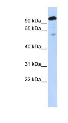 Western Blot: SH2B1 Antibody [NBP1-58319]