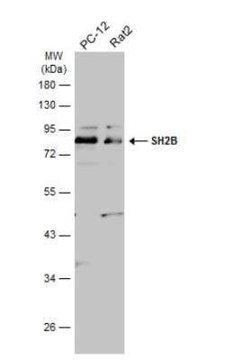 Western Blot: SH2B1 Antibody [NBP2-43830]