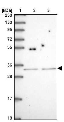 Western Blot: SH2B2 Antibody [NBP2-13305]