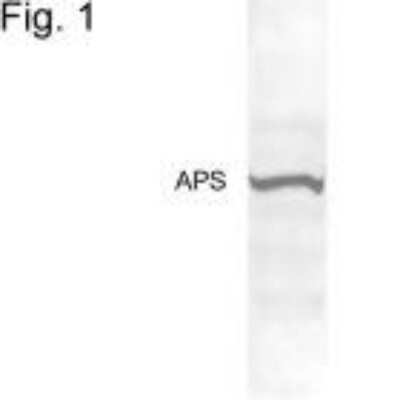 Western Blot: SH2B2 Antibody [NBP2-22515]