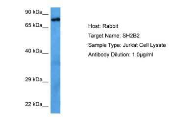 Western Blot: SH2B2 Antibody [NBP2-85716]