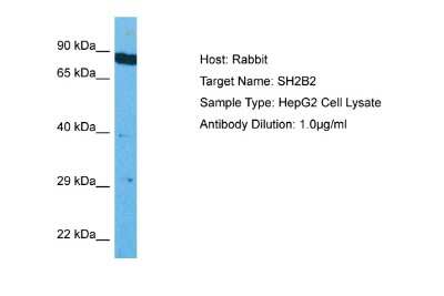 Western Blot: SH2B2 Antibody [NBP2-85717]