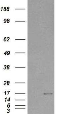 Western Blot: SH2D1A Antibody [NB100-1895]