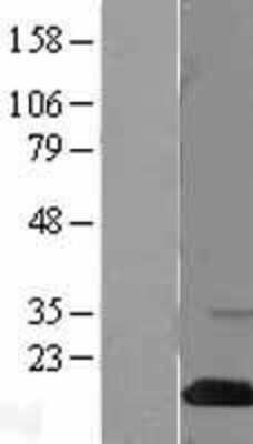 Western Blot: SH2D1A Overexpression Lysate [NBL1-15918]