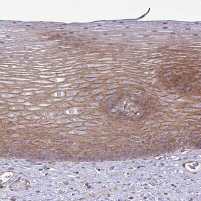 Immunohistochemistry-Paraffin: SH2D1B Antibody [NBP2-33733]